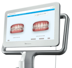 Cerec One-visit dentistry photo